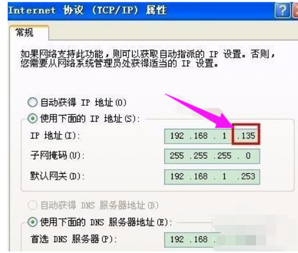 本地連接 本地連接